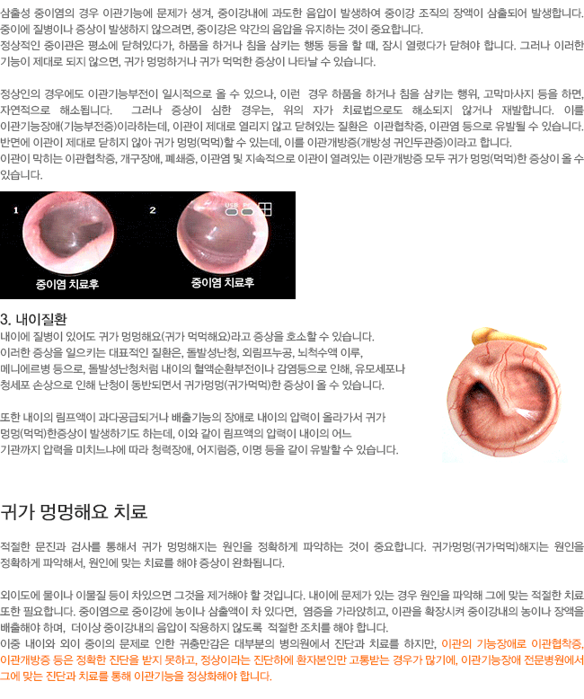 �Ͱ� �۸��ؿ� ġ��(���游�� ġ��)