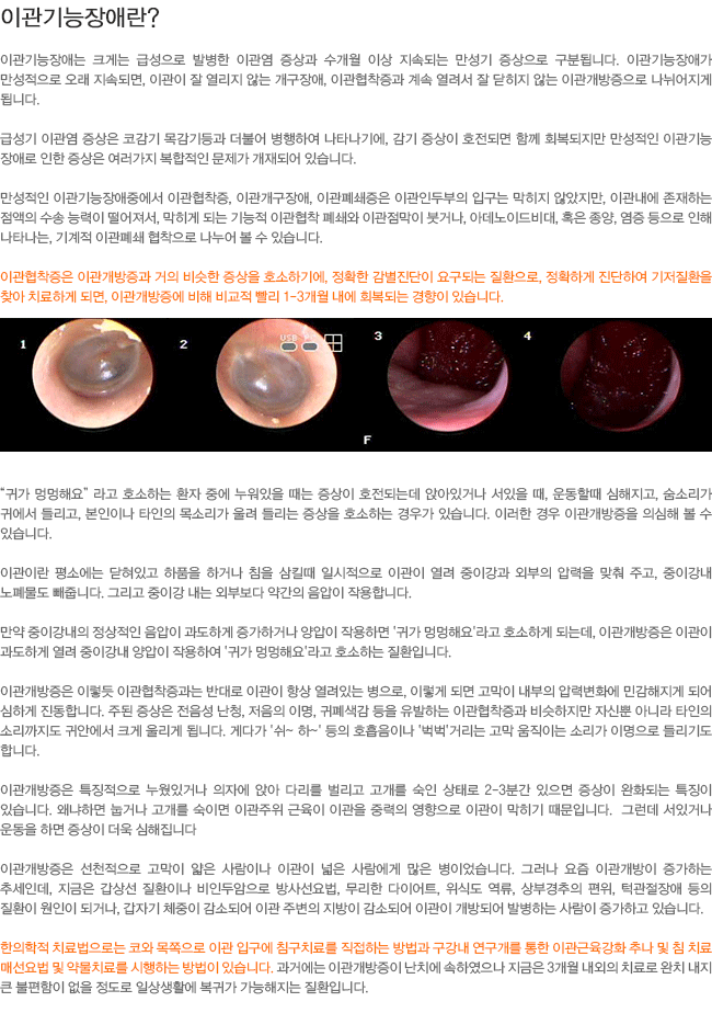 �̰������ֶ�?-�̰��������� �̰��������� ���� ����� ������ ȣ���ϱ⿡, ��Ȯ�� ���������� �䱸�Ǵ� ��ȯ����, ��Ȯ�ϰ� �����Ͽ� ������ȯ�� ã�� ġ���ϰ� �Ǹ�, �̰��������� ���� ���� ���� 1-3���� ���� ȸ���Ǵ� ������ �ֽ��ϴ�. �������� ġ������δ� �ڿ� �������� �̰� �Ա��� ħ��ġ�Ḧ �����ϴ� ����� ������ �������� ���� �̰�������ȭ �߳� �� ħ ġ�� �ż���� �� �๰ġ�Ḧ �����ϴ� ����� �ֽ��ϴ�.