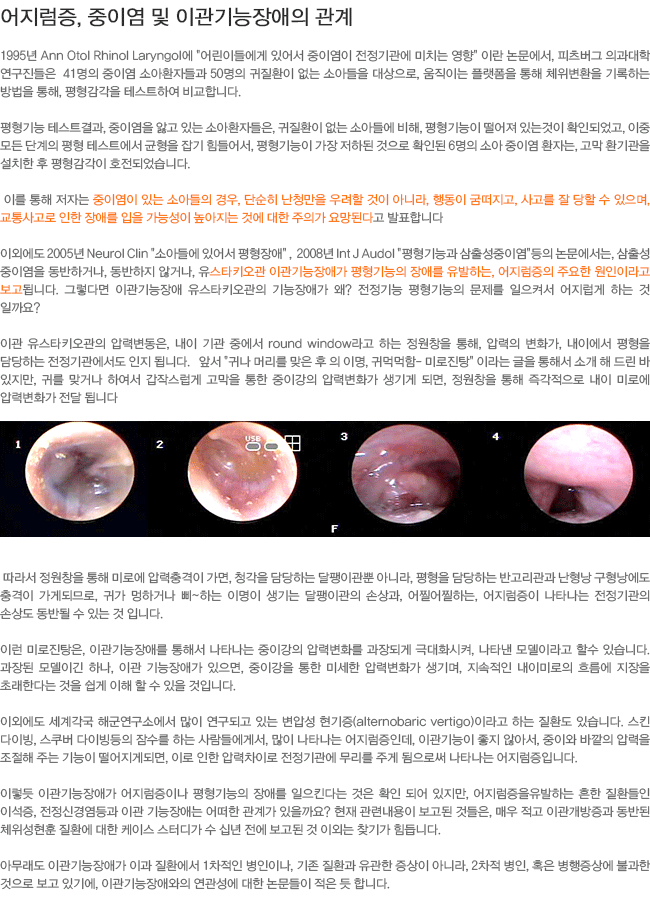 ��������, ���̿� �� �̰��������� ����-����ŸŰ���� �̰������ְ� ��������� ��ָ� �����ϴ� ���������� �ֿ��� �����̶�� �����˴ϴ�.